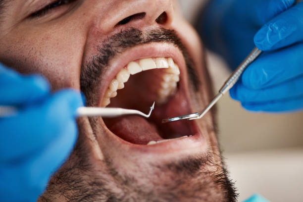 Best Mobile Emergency Dentist in Rockwell, NC