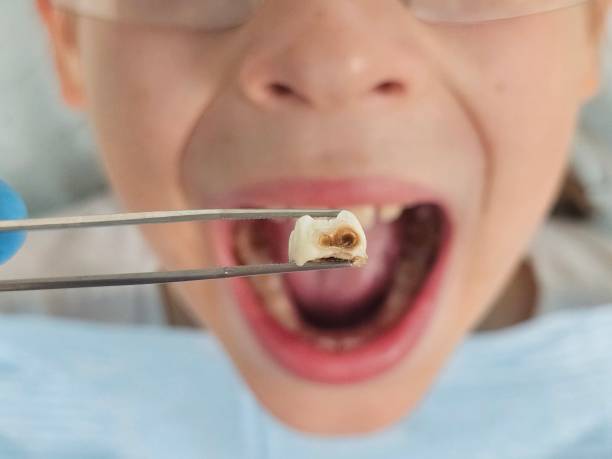 Best Holiday Emergency Dentist in Rockwell, NC
